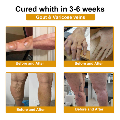 DR.HONOR® All-In-One Joint & Bone Recovery Cream🎉🎉(Specially for older adults)